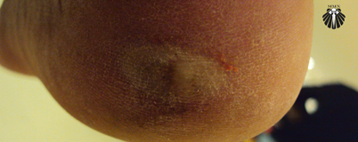 Rota do Caminho Francês